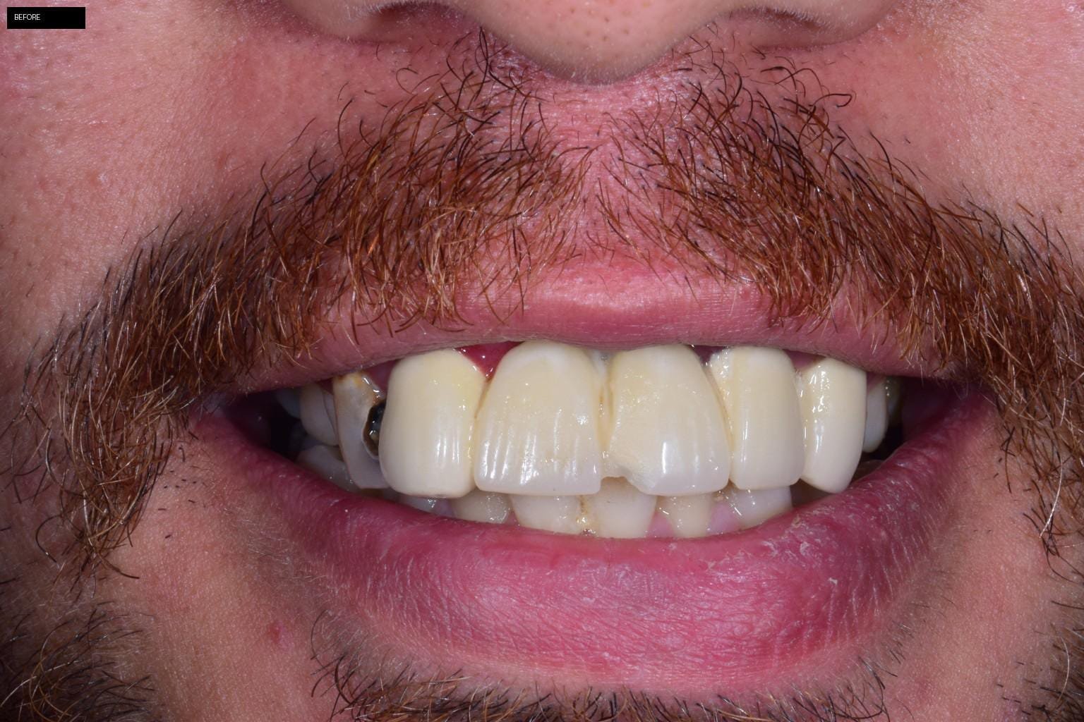تجميل الاسنان